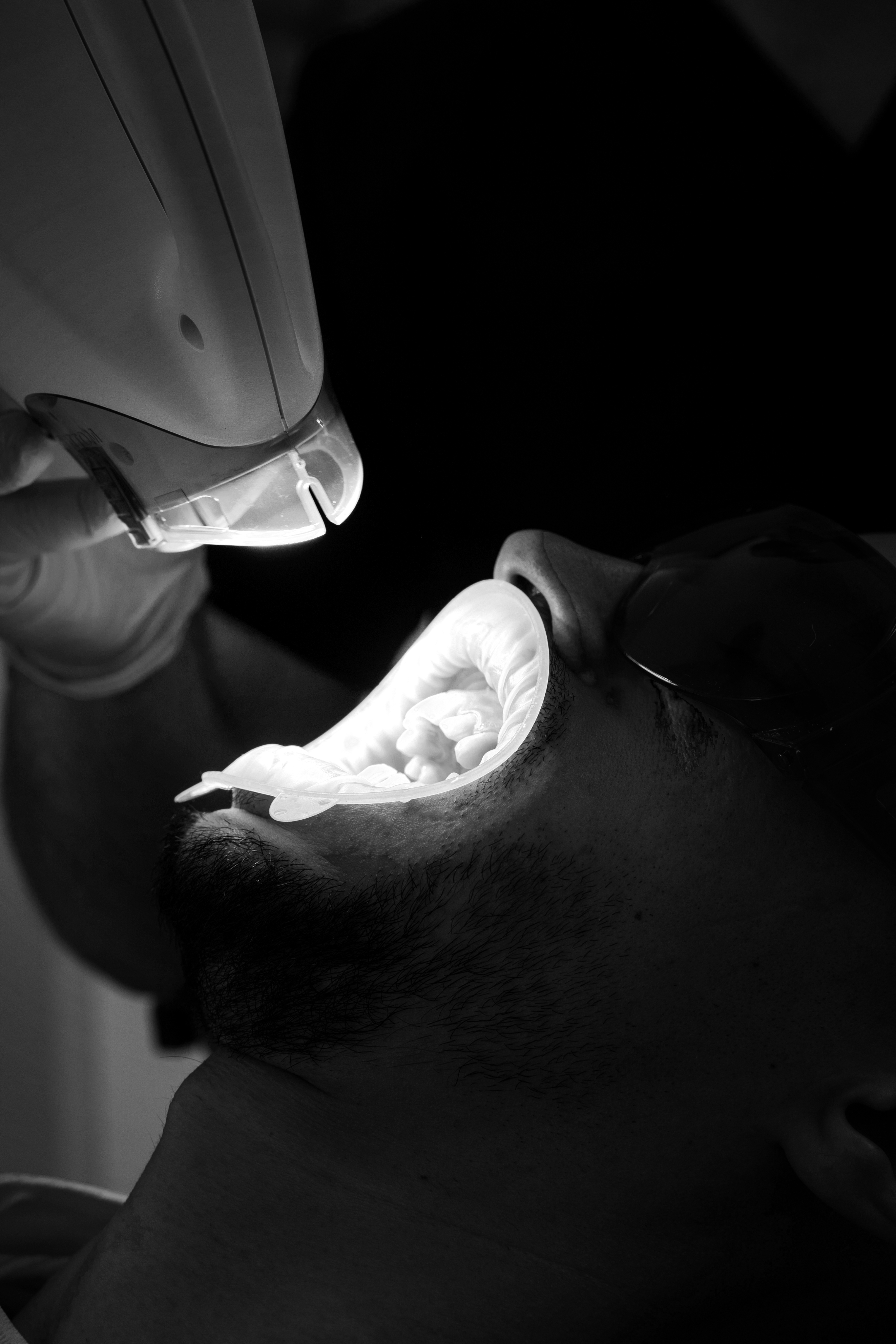 woman being advised about dental beauty whitening procedure