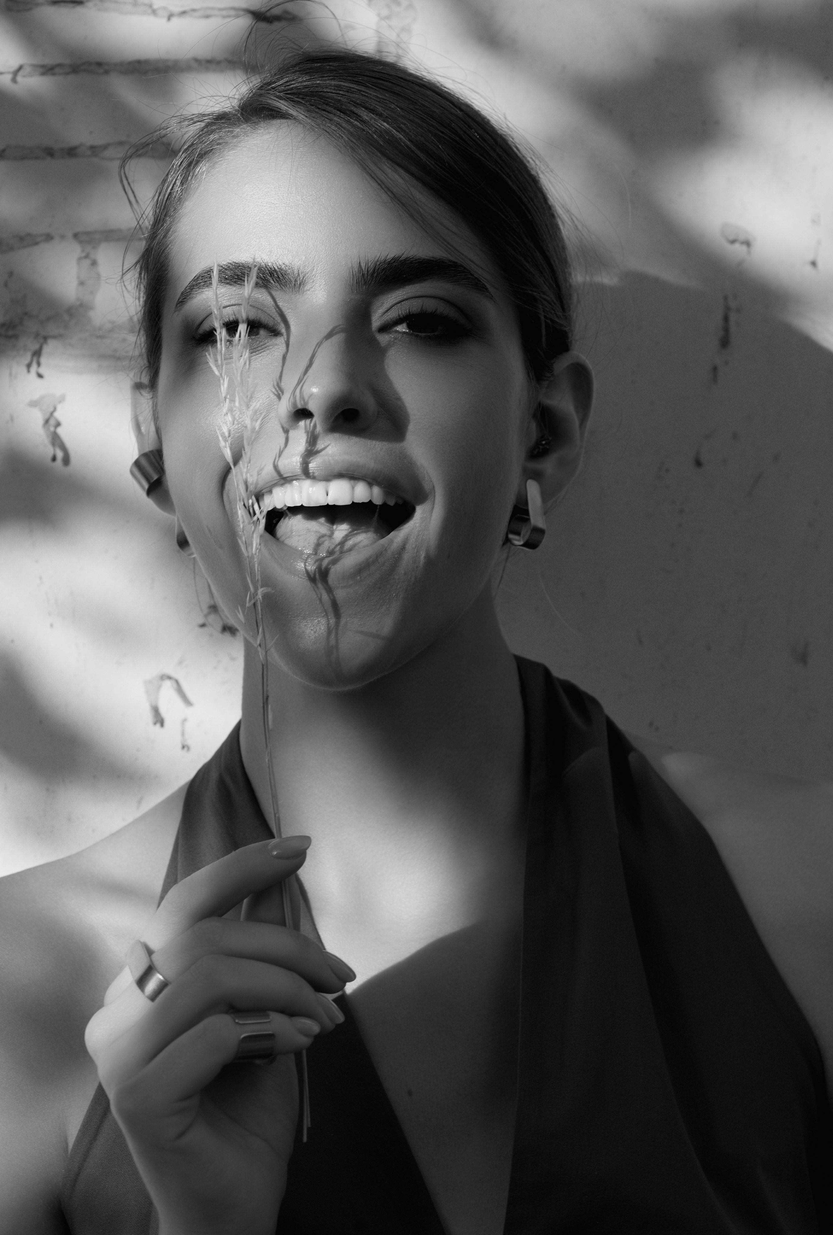 woman being advised about dental beauty whitening procedure